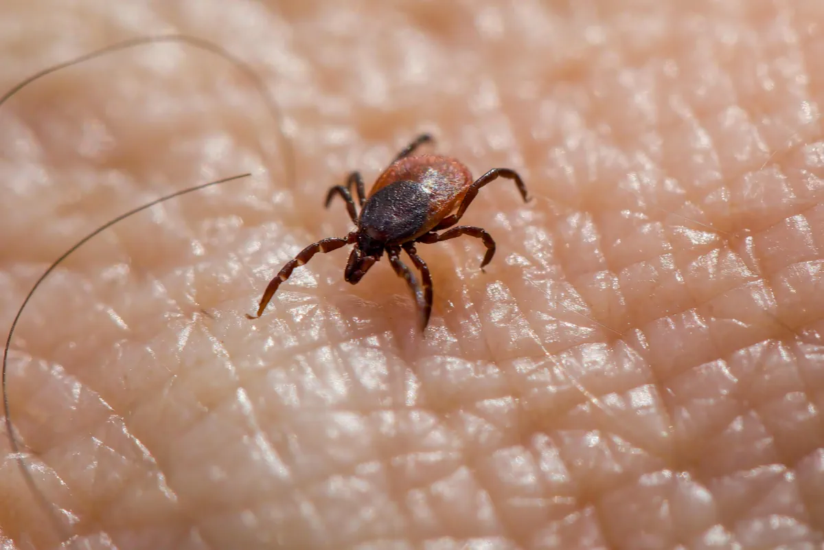 Lyme disease
